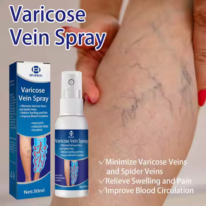 Varicose Veins Treatment Spray!